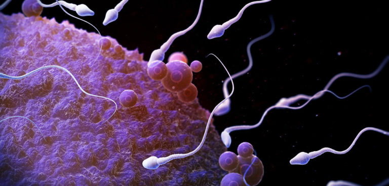 Quelles sont les causes de l'infertilité masculine?
